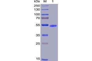 Human GITR Protein, hFc-His Tag on SDS-PAGE under reducing condition. (TNFRSF18 Protein (Fc-His Tag))