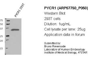 Image no. 1 for anti-Pyrroline-5-Carboxylate Reductase 1 (PYCR1) (Middle Region) antibody (ABIN2787369) (PYCR1 antibody  (Middle Region))