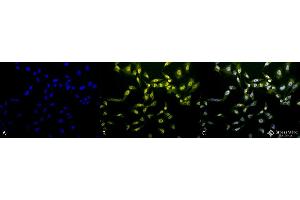 Immunocytochemistry/Immunofluorescence analysis using Rabbit Anti-Phosphothreonine Polyclonal Antibody . (Phosphothreonine antibody  (FITC))