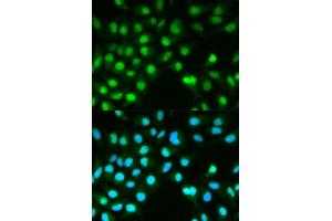 Immunofluorescence analysis of HeLa cell using PPP3CA antibody. (PPP3CA antibody  (AA 1-511))