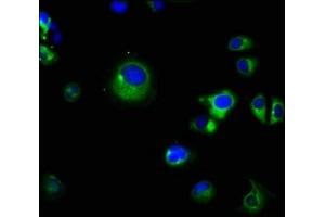 Immunofluorescence staining of MCF-7 cells with ABIN7164878 at 1:66, counter-stained with DAPI.