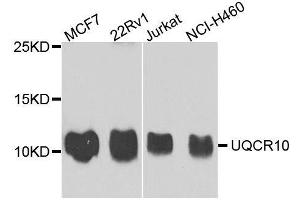 Western blot analysis of extracts of various cell lines, using UQCR10 antibody. (UQCR10 antibody  (AA 1-63))