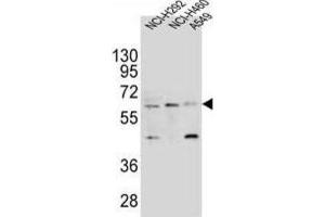 Western Blotting (WB) image for anti-Leukocyte Immunoglobulin-Like Receptor, Subfamily A (With TM Domain), Member 2 (LILRA2) antibody (ABIN2995659)