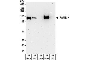 anti-Family with Sequence Similarity 83, Member H (FAM83H) (AA 1129-1179) antibody