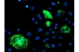 Anti-DHFRL1 mouse monoclonal antibody (ABIN2454838) immunofluorescent staining of COS7 cells transiently transfected by pCMV6-ENTRY DHFRL1 (RC208452). (DHFRL1 antibody  (AA 4-185))