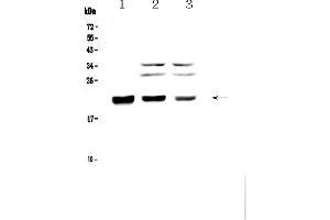 Western Blotting (WB) image for anti-Core-Binding Factor, beta Subunit (CBFB) (AA 1-182) antibody (ABIN5693076)