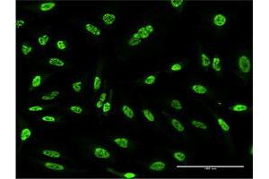 Immunofluorescence of monoclonal antibody to OXSR1 on HeLa cell. (OXSR1 antibody  (AA 351-450))