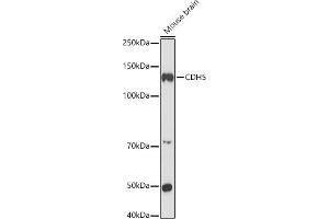 Western blot analysis of extracts of Mouse brain, using CDH5 antibody (ABIN6134029, ABIN6138297, ABIN6138298 and ABIN6216033) at 1:1000 dilution. (Cadherin 5 antibody  (AA 650-750))
