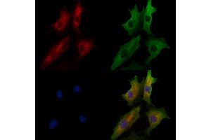ABIN7094611 and ABIN7098661 staining  cells by IF/ICC.