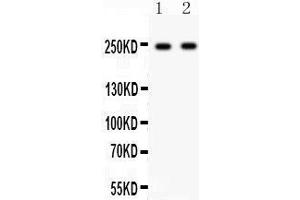 Western Blotting (WB) image for anti-Calcium Channel, Voltage-Dependent, L Type, alpha 1D Subunit (CACNA1D) (AA 1-180) antibody (ABIN3043768)