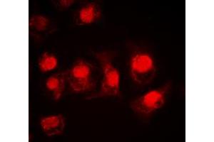 Immunofluorescent analysis of MSK1 staining in HEK293T cells. (MSK1 antibody  (Center))