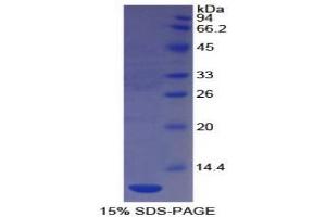 SDS-PAGE analysis of Human PECAM1 Protein.