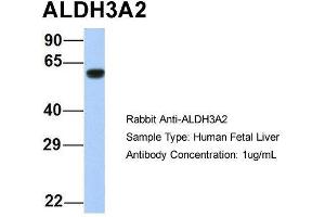 Host:  Rabbit  Target Name:  ALDH3A2  Sample Type:  Human Fetal Liver  Antibody Dilution:  1. (ALDH3A2 antibody  (Middle Region))