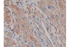 Immunohistochemistry (IHC) image for anti-Actin, gamma 2, Smooth Muscle, Enteric (ACTG2) (AA 3-376) antibody (ABIN7440569)