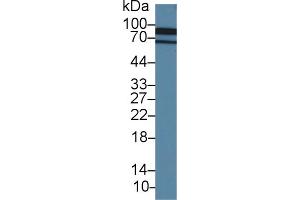 Western Blot; Sample: Porcine Cerebrum lysate; Primary Ab: 1. (Cadherin 13 antibody  (AA 179-366))