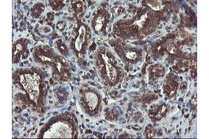 Immunohistochemical staining of paraffin-embedded Human breast tissue using anti-ACBD3 mouse monoclonal antibody. (ACBD3 antibody)