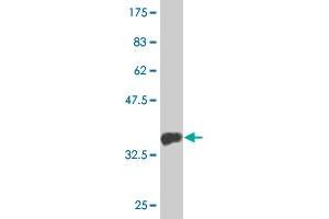Western Blot detection against Immunogen (33. (MTMR1 antibody  (AA 39-112))