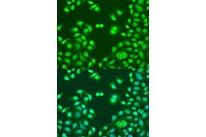 Immunofluorescence analysis of U2OS cells using NUM antibody (ABIN1681136, ABIN3015188, ABIN3015190 and ABIN6213875) at dilution of 1:100. (NUMA1 antibody  (AA 1-309))