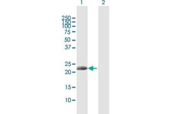 IL17D Antikörper  (AA 1-202)