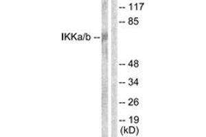 Western blot analysis of extracts from Jurkat cells, using IKK-alpha/beta (Ab-176/177) Antibody. (IKK-alpha /IKK-beta antibody  (AA 151-200))