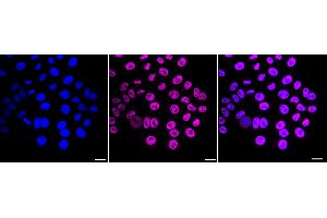anti-Cyclin-Dependent Kinase 9 (CDK9) antibody