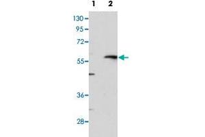 Western blot analysis of MMP13 (arrow) using MMP13 polyclonal antibody . (MMP13 antibody  (C-Term))
