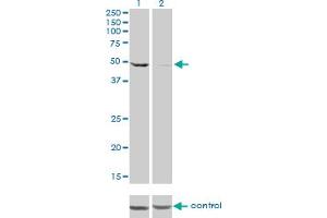 Western Blotting (WB) image for anti-DEAD (Asp-Glu-Ala-Asp) Box Polypeptide 6 (DDX6) (AA 1-484) antibody (ABIN598641) (DDX6 antibody  (AA 1-484))