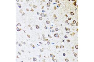 Immunohistochemistry of paraffin-embedded mouse brain using SERPINA10 antibody at dilution of 1:100 (40x lens).