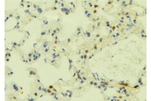 ABIN6273849 at 1/100 staining Mouse lung tissue by IHC-P. (FPR2 antibody  (C-Term))