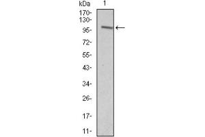 Western blot analysis using VAV1 antibody against HEK293 (1) and VAV1 (AA: 121-324) -hIgGFc transfected HEK293 (2) cell lysate. (VAV1 antibody  (AA 121-324))