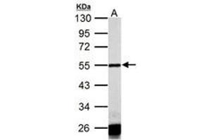 Calsequestrin 抗体  (AA 136-381)