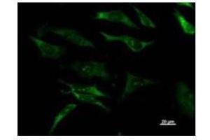 Immunostaining analysis in HeLa cells. (DHX29 antibody)