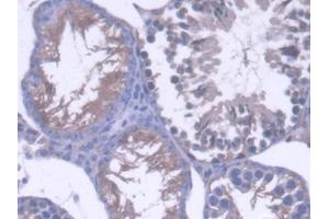 IHC-P analysis of Mouse Testis Tissue, with DAB staining.