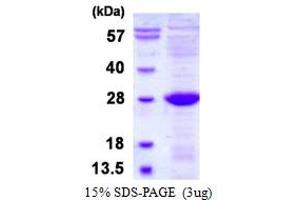 Image no. 1 for UL16 Binding Protein 2 (ULBP2) protein (His tag) (ABIN1098658)