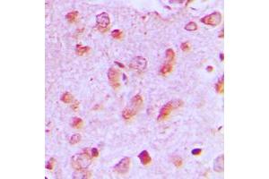 Immunohistochemical analysis of JIP2 staining in human brain formalin fixed paraffin embedded tissue section. (IB2 antibody  (C-Term))