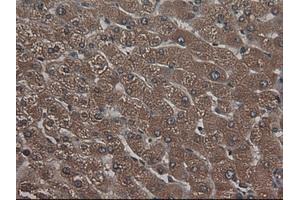 Image no. 1 for anti-Carboxypeptidase A1 (Pancreatic) (CPA1) (AA 1-419) antibody (ABIN1490772)