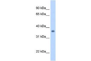 SGCG antibody used at 1. (SGCG antibody)