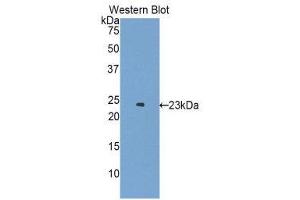 Western Blotting (WB) image for anti-Erythropoietin Receptor (EPOR) (AA 45-244) antibody (ABIN1172012)