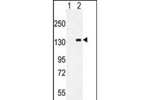 Western blot analysis of CSF1R (arrow) using mouse Monoclonal CSF1R ABIN659076. (CSF1R antibody)