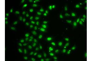 Immunofluorescence analysis of MCF7 cell using DUSP22 antibody.