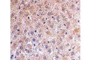 Immunohistochemistry (IHC) image for anti-Tumor Protein P53 Inducible Nuclear Protein 1 (TP53INP1) (N-Term) antibody (ABIN1031500)