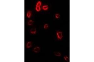 Immunofluorescent analysis of Stomatin staining in Hela cells. (Stomatin antibody)
