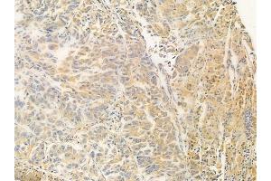 anti-DEAD (Asp-Glu-Ala-Asp) Box Polypeptide 20 (DDX20) (Internal Region) antibody