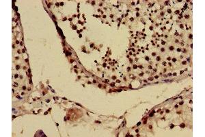 Immunohistochemistry of paraffin-embedded human testis tissue using ABIN7153811 at dilution of 1:100 (USO1 antibody  (AA 591-733))