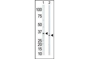 The anti-PRPS1/2/3 Pab is used in Western blot to detect PRPS1/2/3 in mouse kidney tissue lysate (Lane 1) and Hela cell lysate (Lane 2). (PRPS1 antibody  (N-Term))