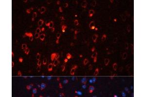Immunofluorescence analysis of Mouse brain using KCNA1 Polyclonal Antibody at dilution of 1:100. (KCNA1 antibody)
