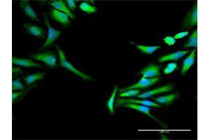 Immunofluorescence of purified MaxPab antibody to HOMER1 on HeLa cell. (HOMER1 antibody  (AA 1-354))