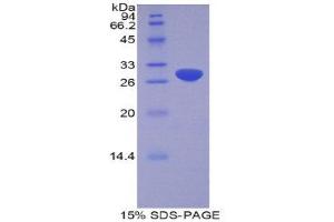 SDS-PAGE (SDS) image for ADAM Metallopeptidase Domain 20 (ADAM20) (AA 367-615) protein (His tag) (ABIN2120417)