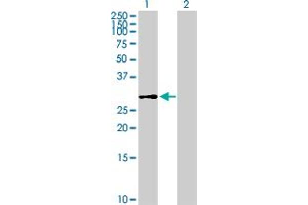 DHDDS antibody  (AA 1-294)