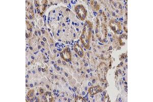 Immunohistochemistry of paraffin-embedded rat kidney using EPXH2 antibody at dilution of 1:200 (x400 lens). (EPHX2 antibody)